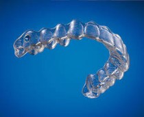 Invisalign folie